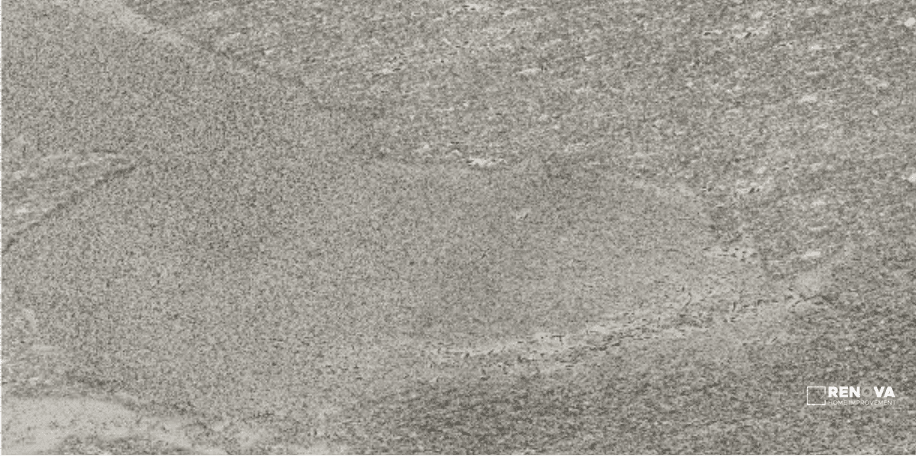 KLIF 14.75" X 29.5"